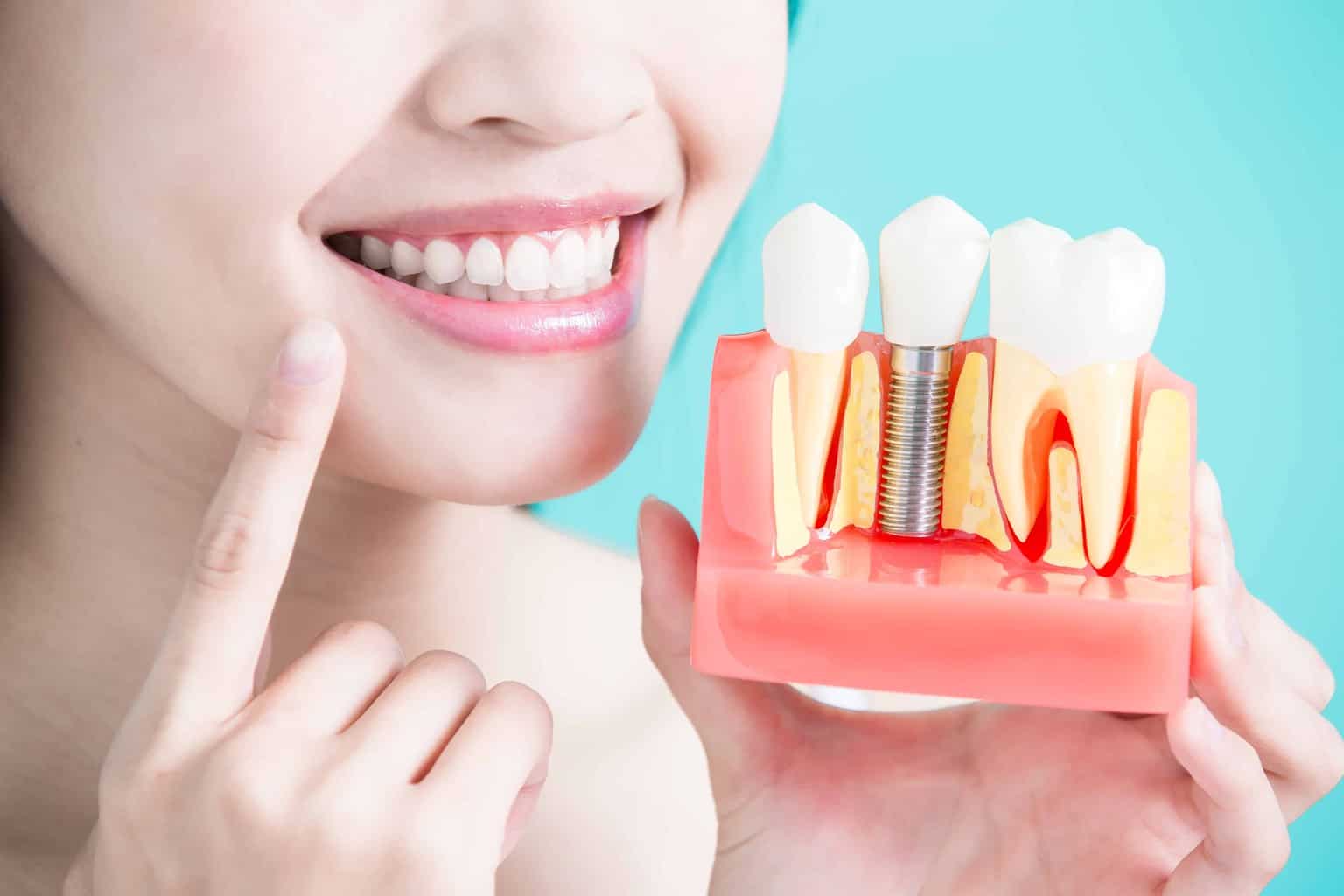 cosmetic Dentistry, composite fillings, Mentone dentist, Mentone cosmetic dentist