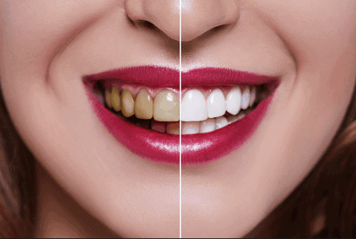 cosmetic dentistry Treatment