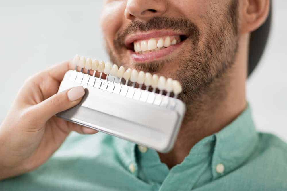 What Happens To Teeth Underneath The Veneers? Parkdale Family Dental