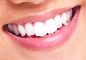 a patient showing off a smile with veneers