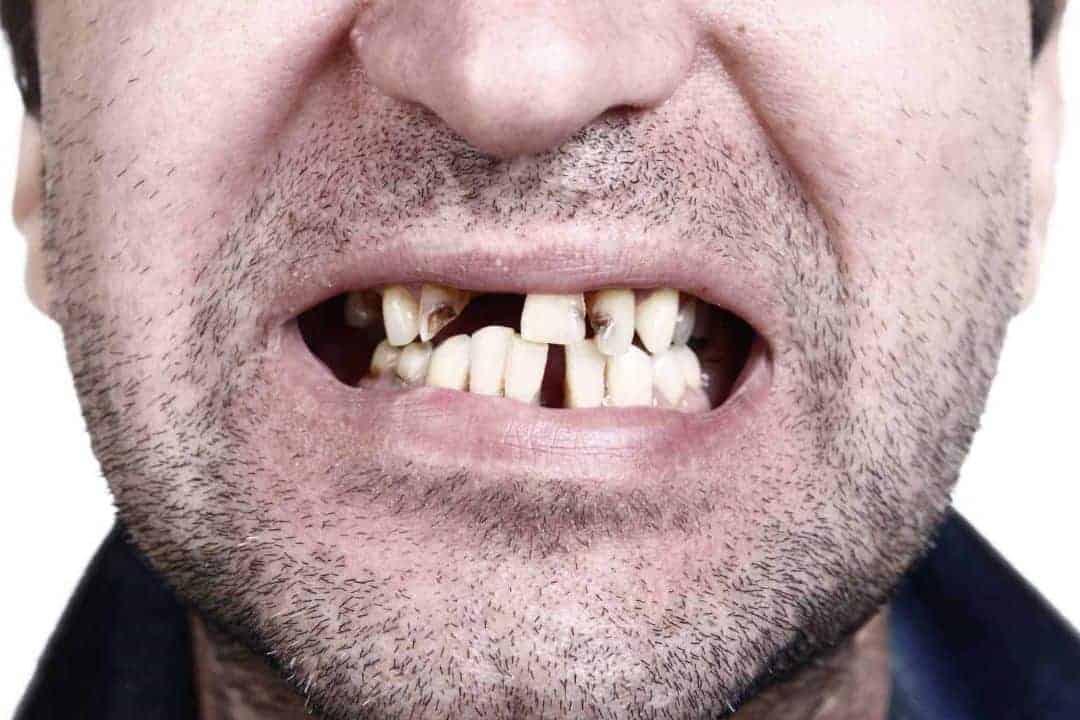 Can bad teeth be fixed